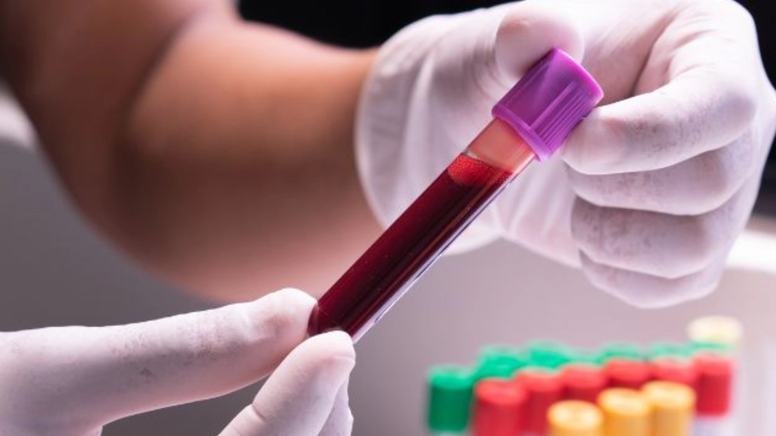 Hematología